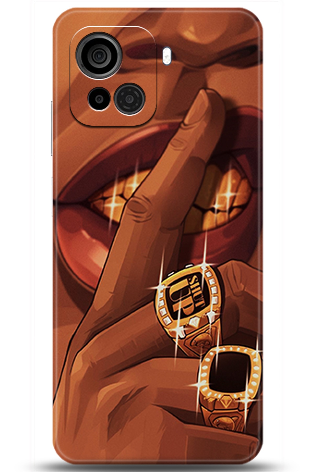 Casper Via F30 Uyumlu Kılıf HD Baskılı Kılıf - Followed Institution 5631