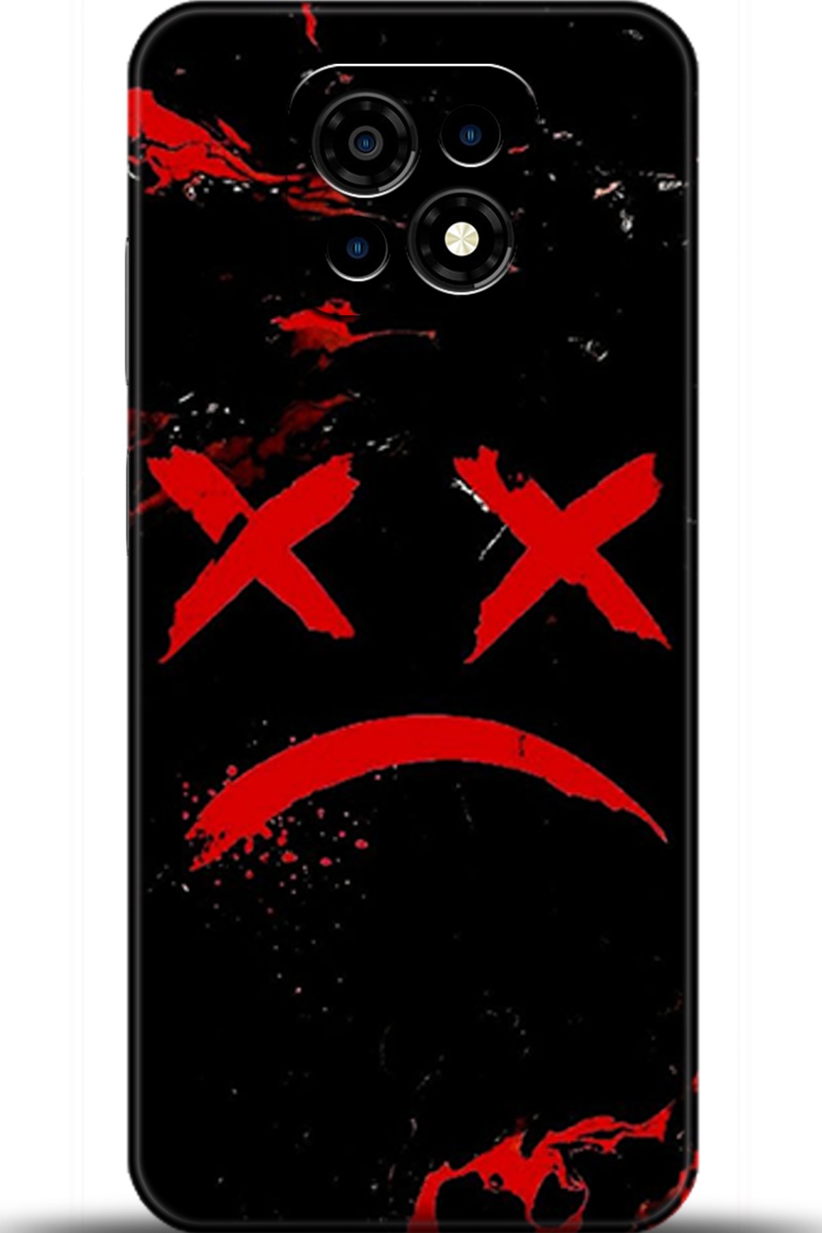 Casper Via M30 Uyumlu Kılıf HD Baskılı Kılıf - Followed Institution 5139