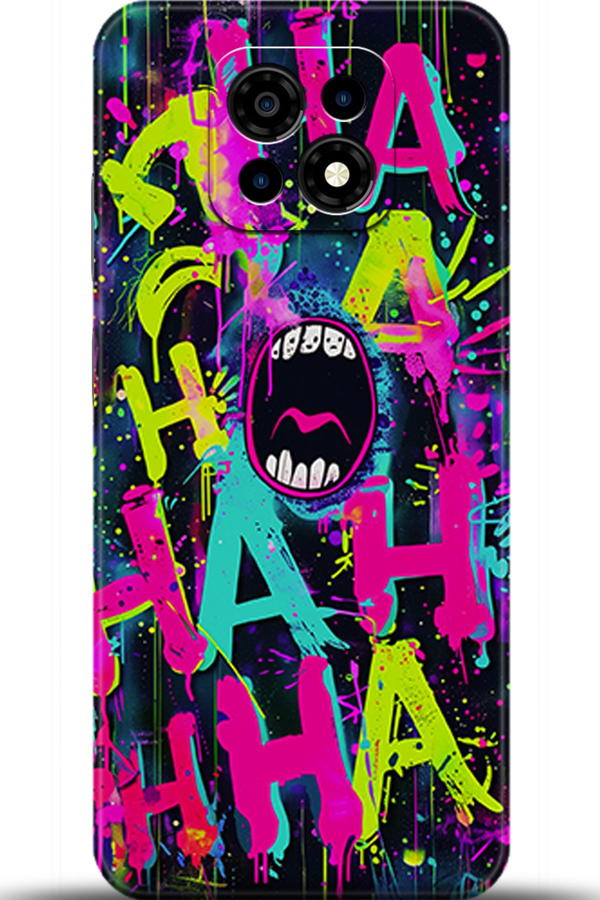 Casper Via M30 Uyumlu Kılıf HD Baskılı Kılıf - Followed Institution 5672