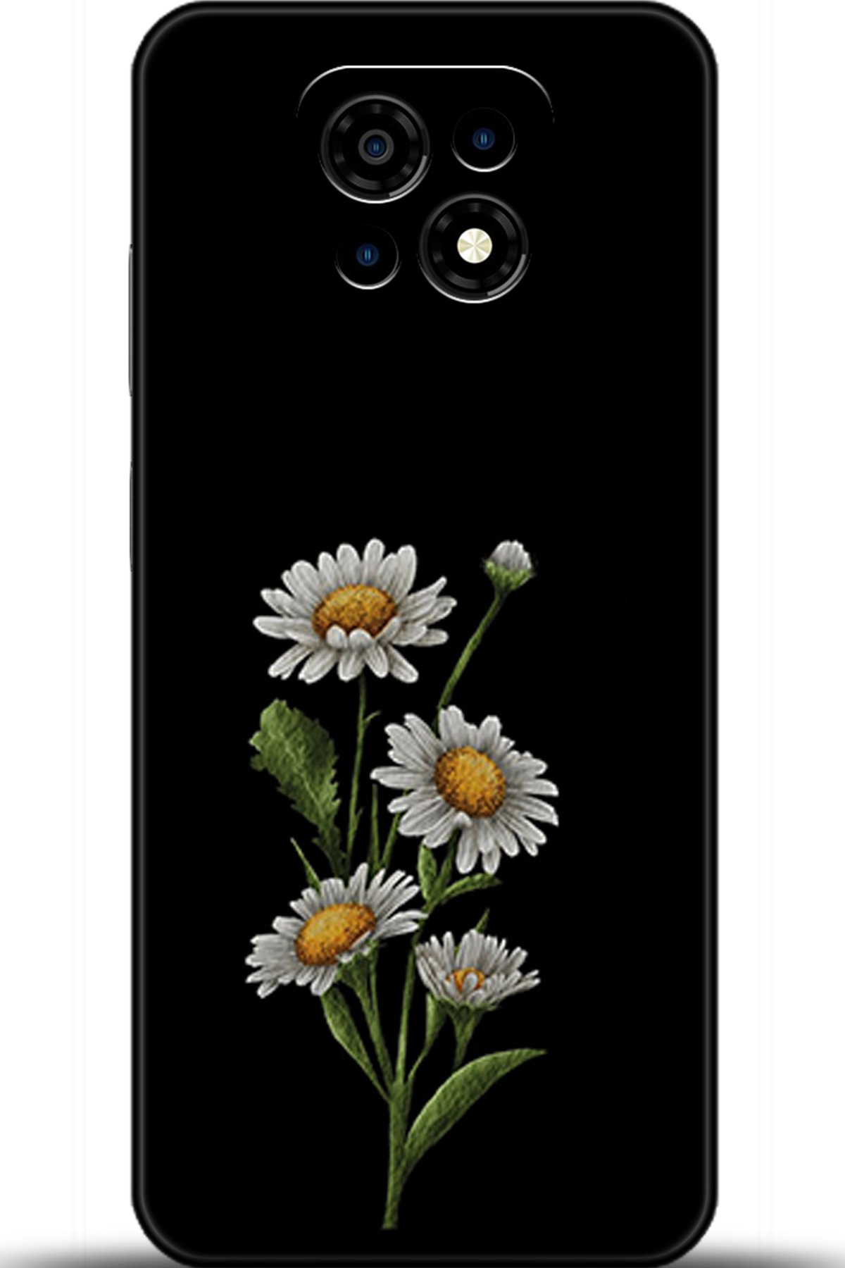 Casper Via M30 Uyumlu Kılıf HD Baskılı Kılıf - Followed Institution 5756