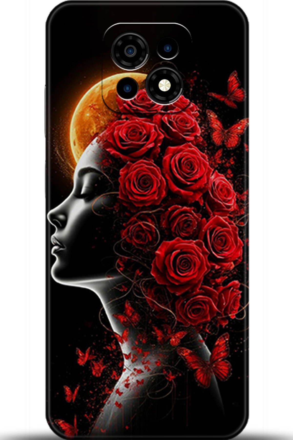 Casper Via M30 Uyumlu Kılıf HD Baskılı Kılıf - Followed Institution 5864