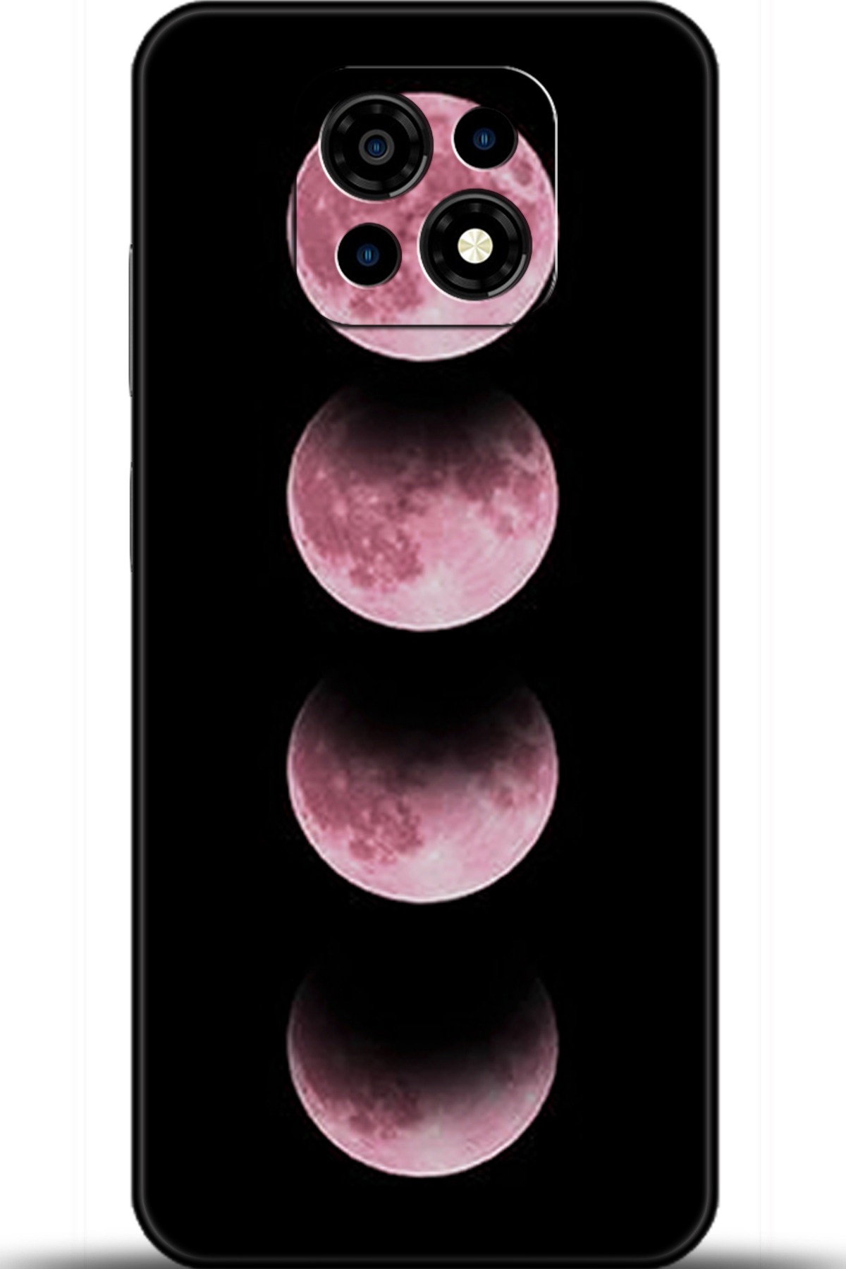 Casper Via M30 Uyumlu Kılıf HD Baskılı Kılıf - Followed Institution 5915