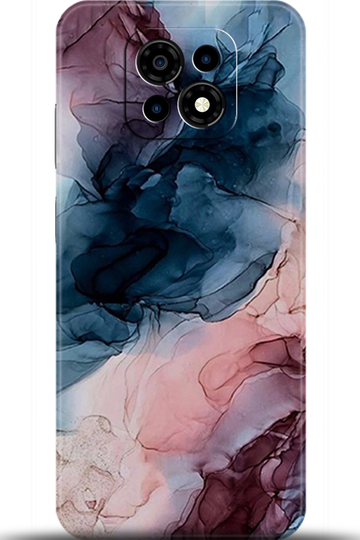 Casper Via M30 Uyumlu Kılıf HD Baskılı Kılıf - Followed Institution 5985