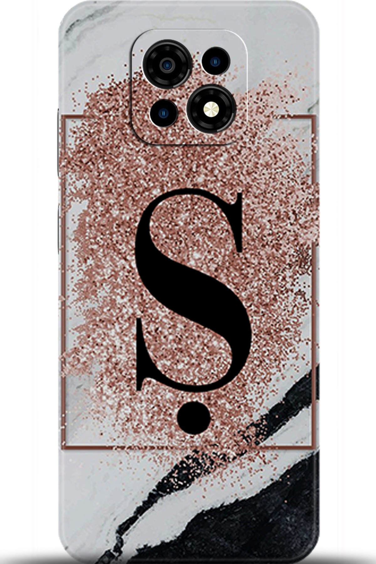 Casper Via M30 Uyumlu Kılıf HD Baskılı Kılıf - Followed Institution 5999