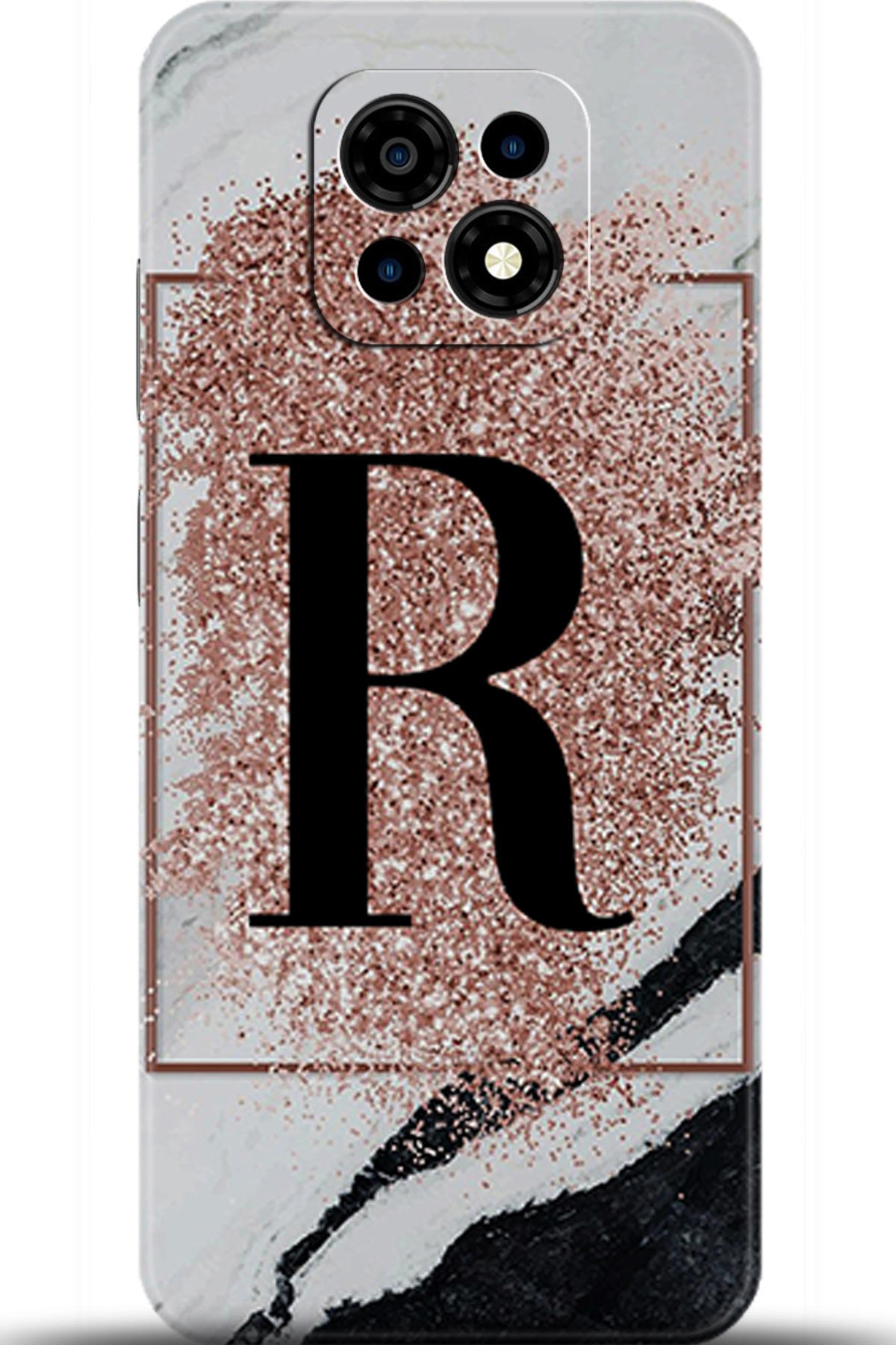 Casper Via M30 Uyumlu Kılıf HD Baskılı Kılıf - Followed Institution 6001