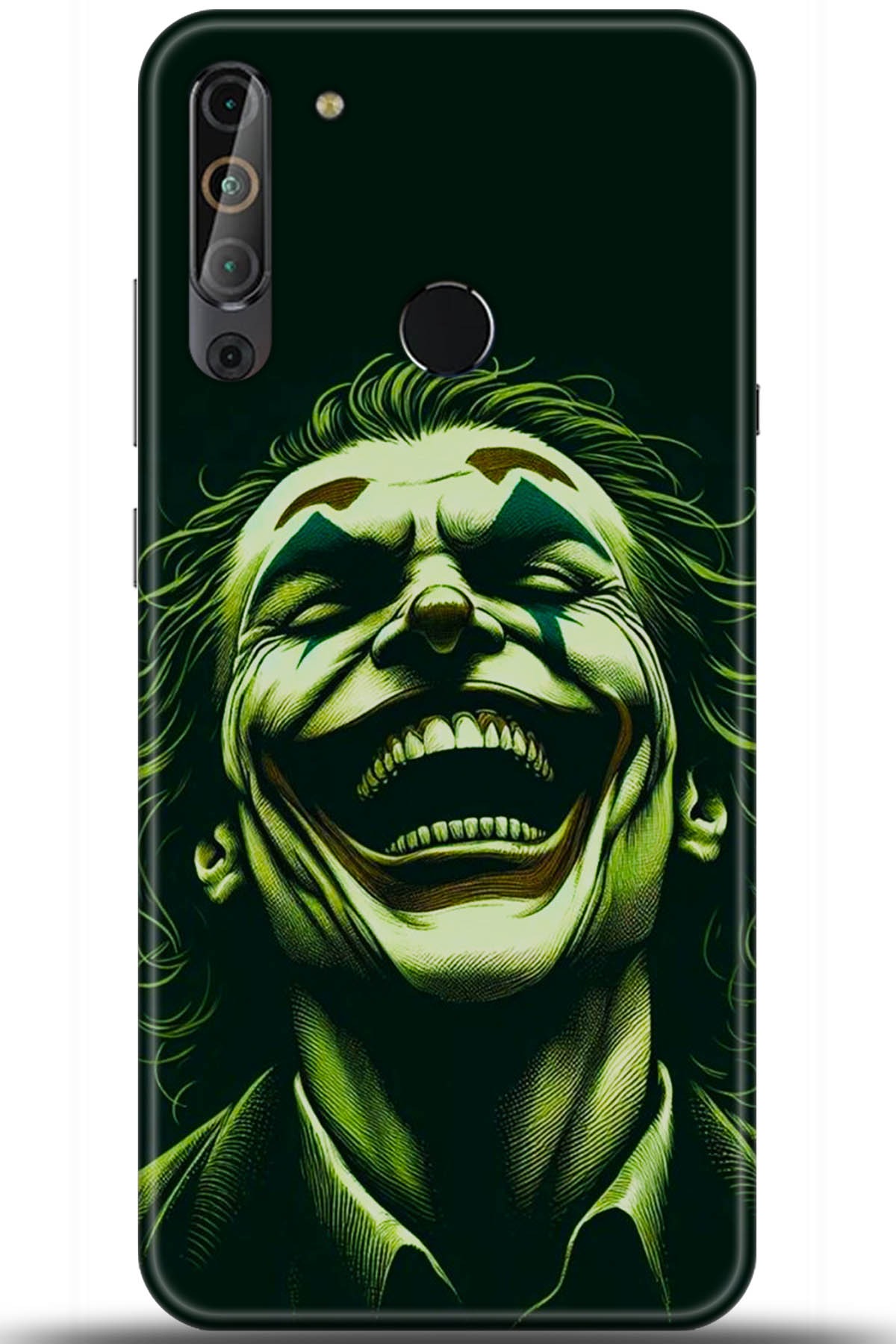 Casper Via X20 Uyumlu Kılıf HD Baskılı Kılıf - Followed Institution 5415