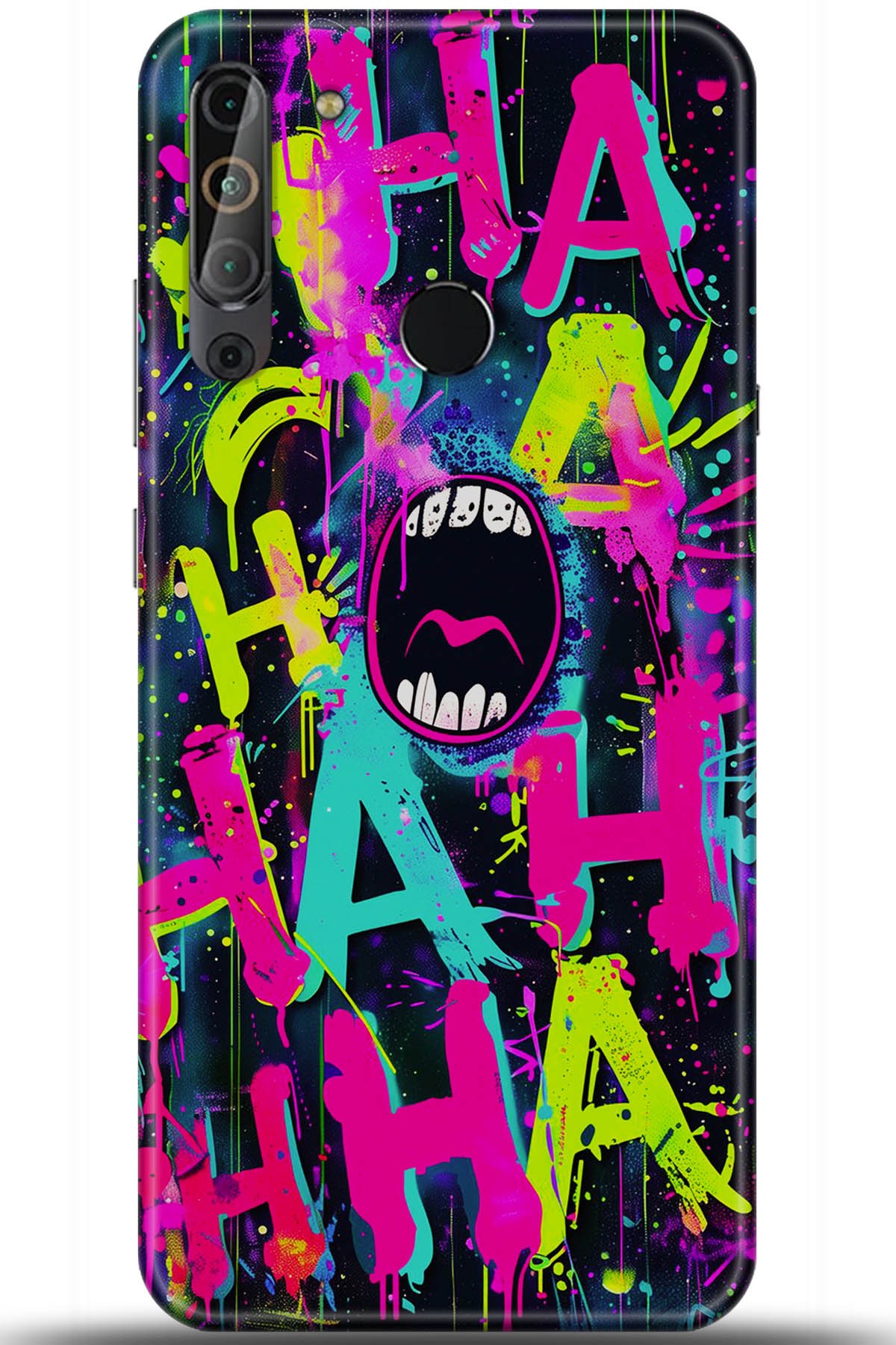 Casper Via X20 Uyumlu Kılıf HD Baskılı Kılıf - Followed Institution 5672