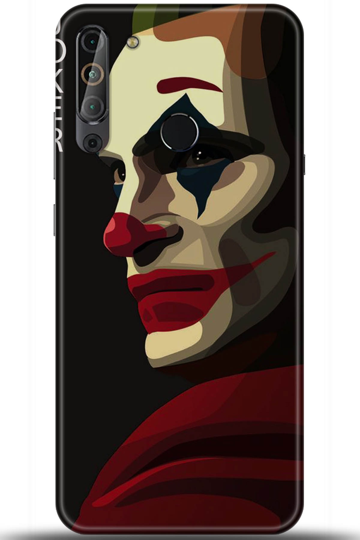 Casper Via X20 Uyumlu Kılıf HD Baskılı Kılıf - Followed Institution 5689