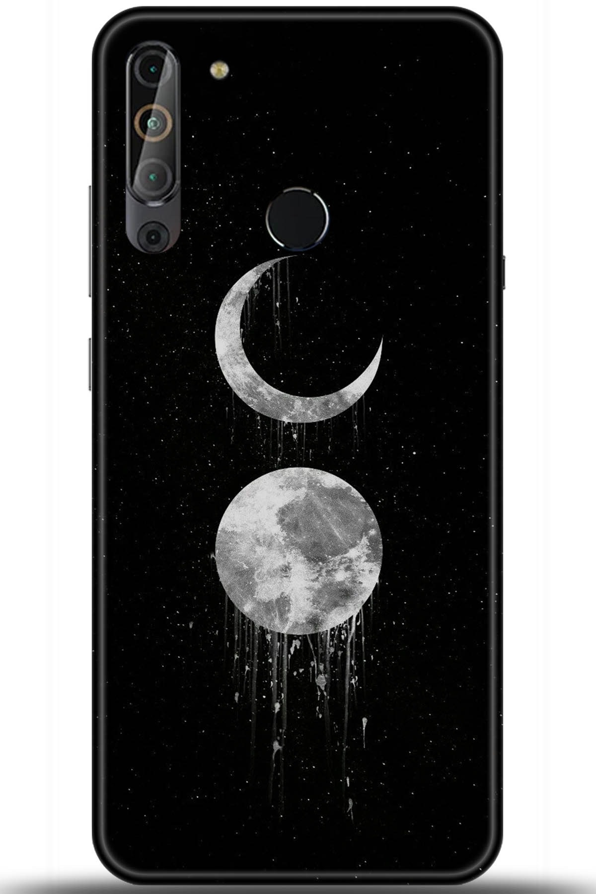 Casper Via X20 Uyumlu Kılıf HD Baskılı Kılıf - Followed Institution 5788