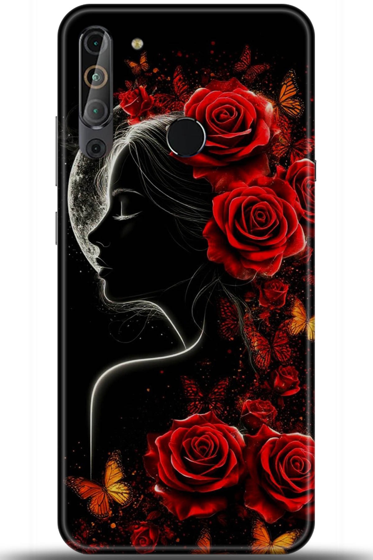 Casper Via X20 Uyumlu Kılıf HD Baskılı Kılıf - Followed Institution 5863