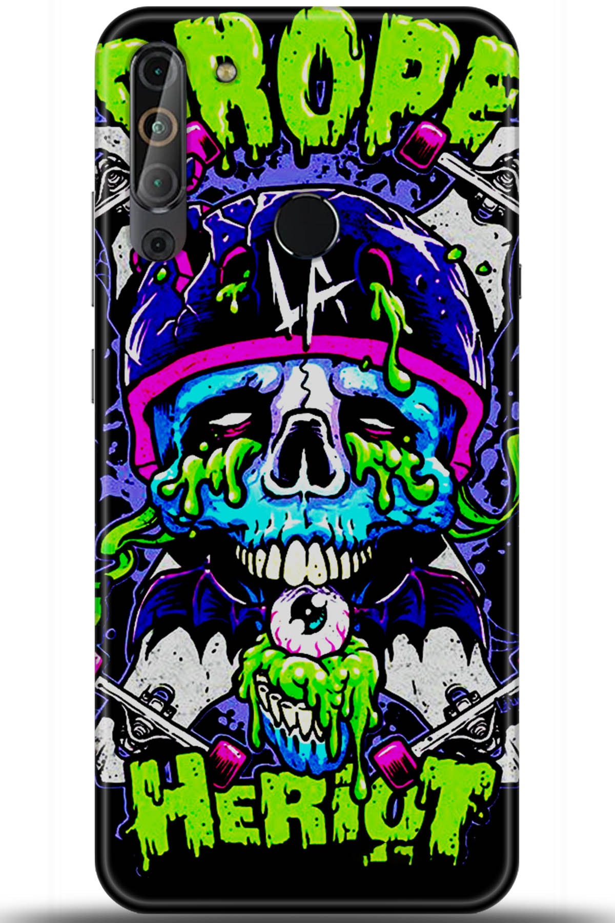 Casper Via X20 Uyumlu Kılıf HD Baskılı Kılıf - Followed Institution 5970