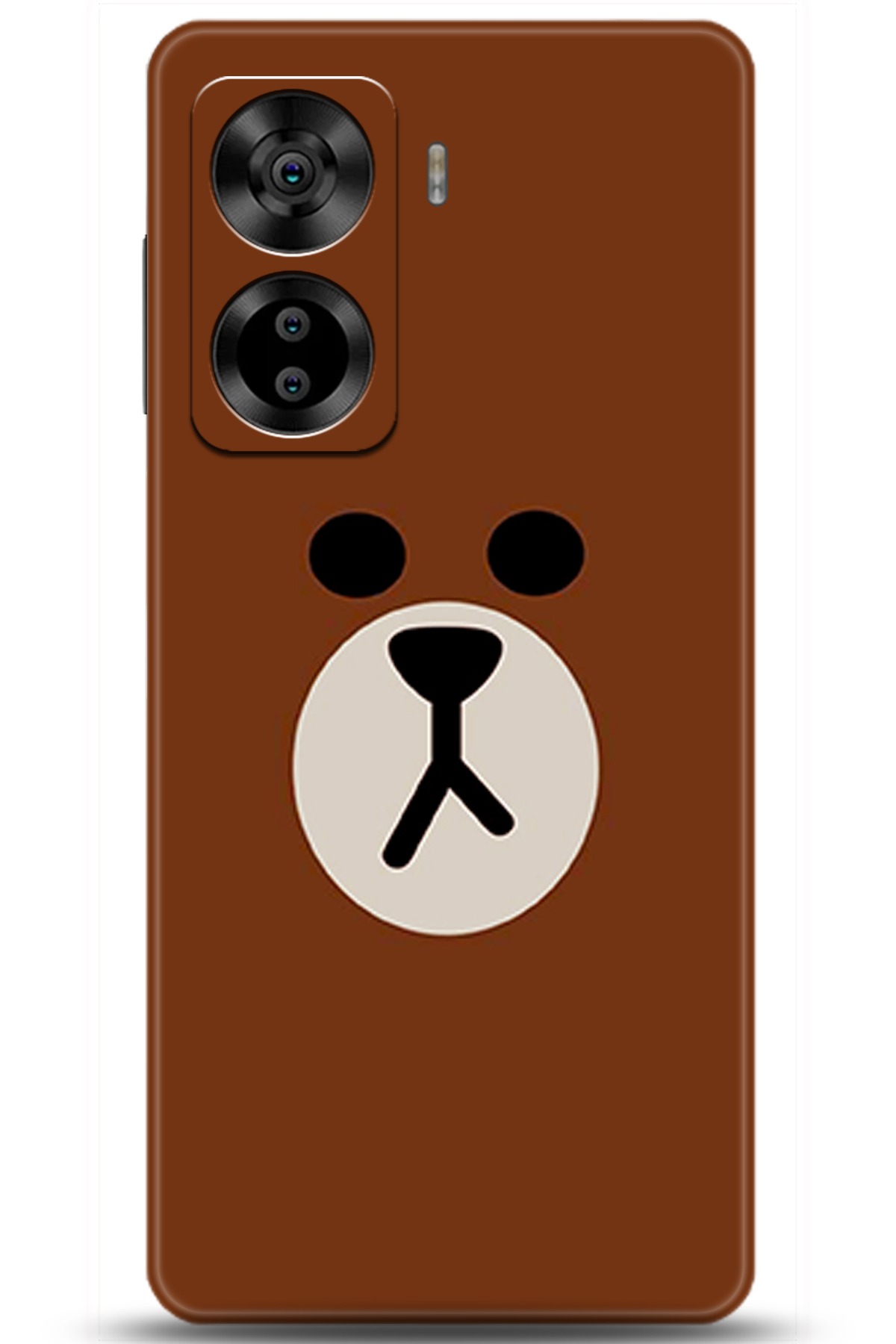 Casper Via X40 Uyumlu Kılıf HD Baskılı Kılıf - Followed Institution 5430