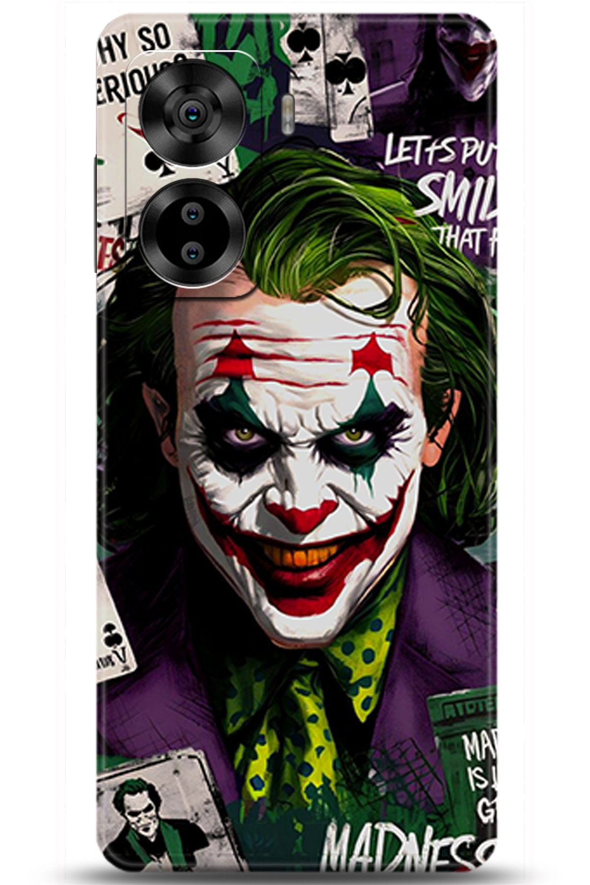 Casper Via X40 Uyumlu Kılıf HD Baskılı Kılıf - Followed Institution 5673