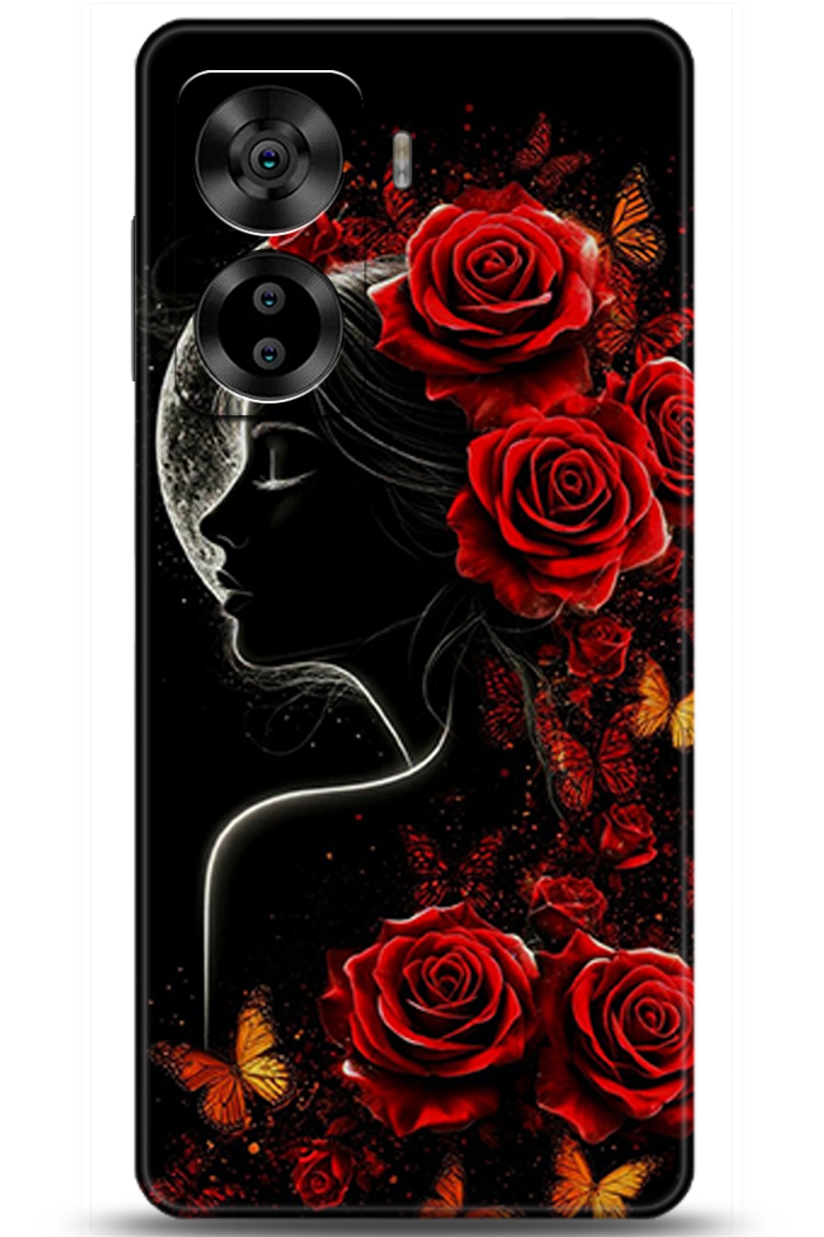 Casper Via X40 Uyumlu Kılıf HD Baskılı Kılıf - Followed Institution 5863