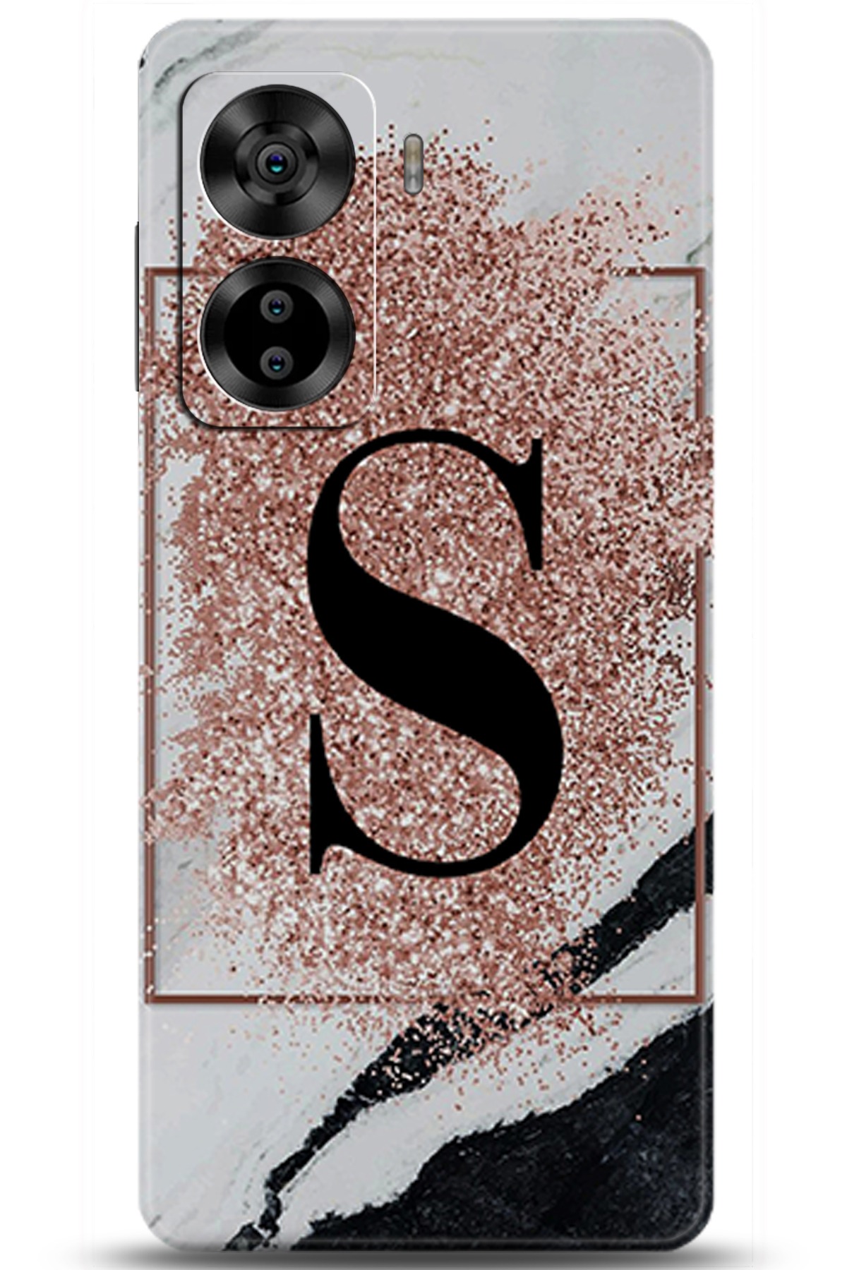 Casper Via X40 Uyumlu Kılıf HD Baskılı Kılıf - Followed Institution 6000