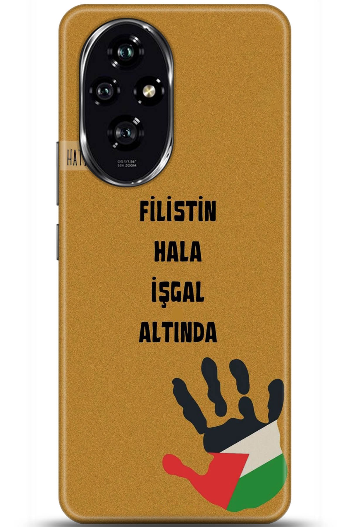 Honor 200 Uyumlu Kılıf HD Baskılı Kılıf - Followed Institution 5740