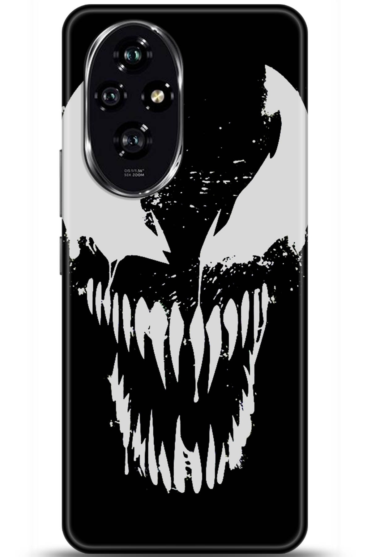 Honor 200 Uyumlu Kılıf HD Baskılı Kılıf - Followed Institution 5939