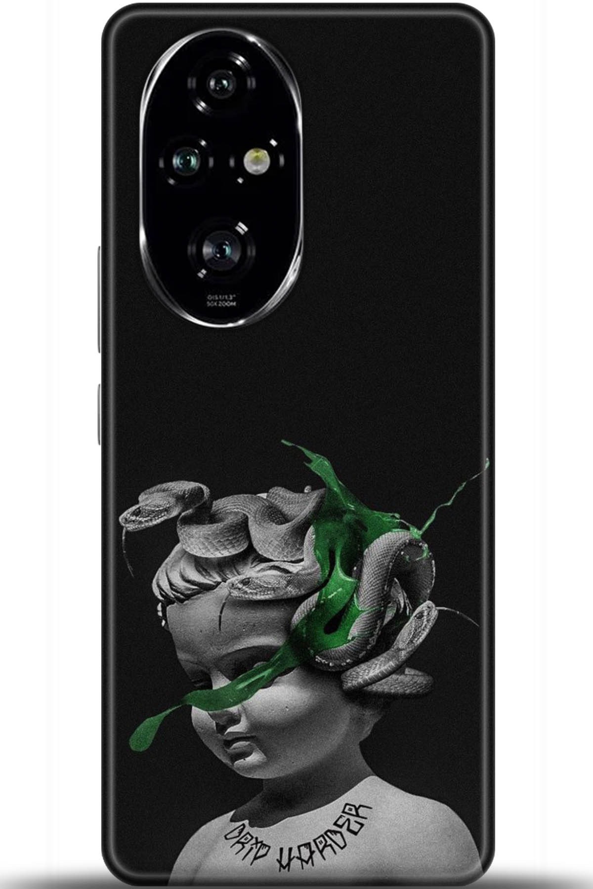 Honor 200 Pro Uyumlu Kılıf HD Baskılı Kılıf - Followed Institution 5077