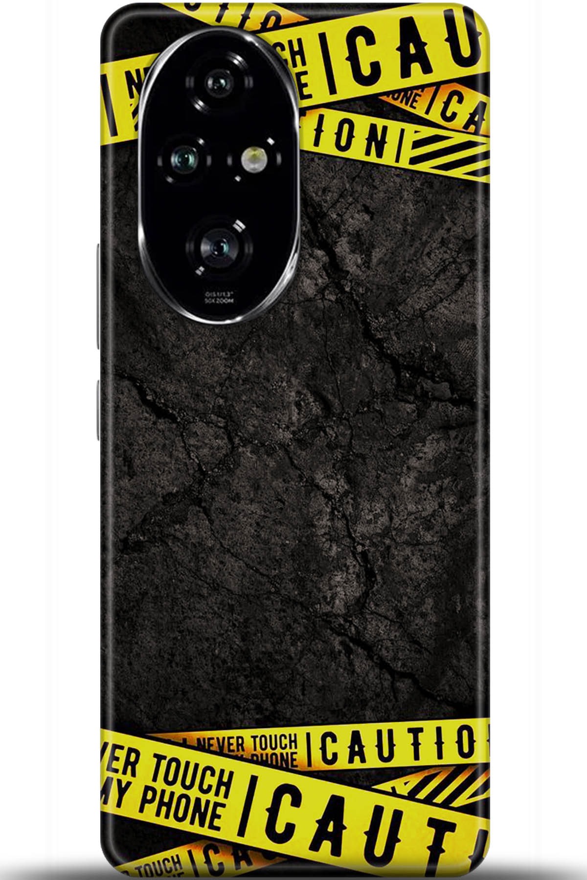 Honor 200 Pro Uyumlu Kılıf HD Baskılı Kılıf - Followed Institution 5514