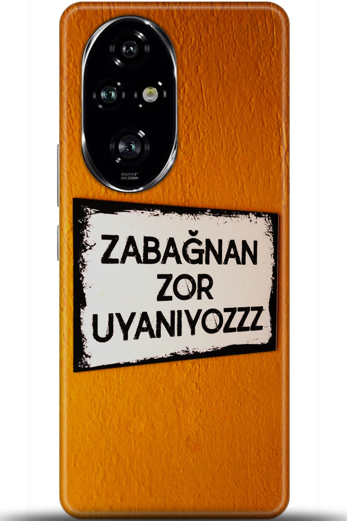 Honor 200 Pro Uyumlu Kılıf HD Baskılı Kılıf - Followed Institution 5590