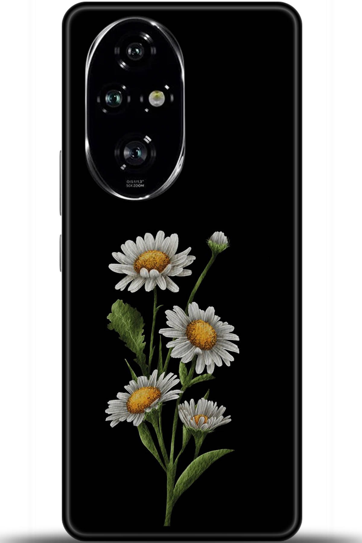 Honor 200 Pro Uyumlu Kılıf HD Baskılı Kılıf - Followed Institution 5756