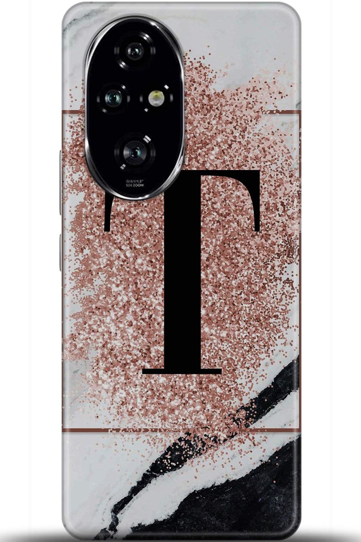 Honor 200 Pro Uyumlu Kılıf HD Baskılı Kılıf - Followed Institution 5998