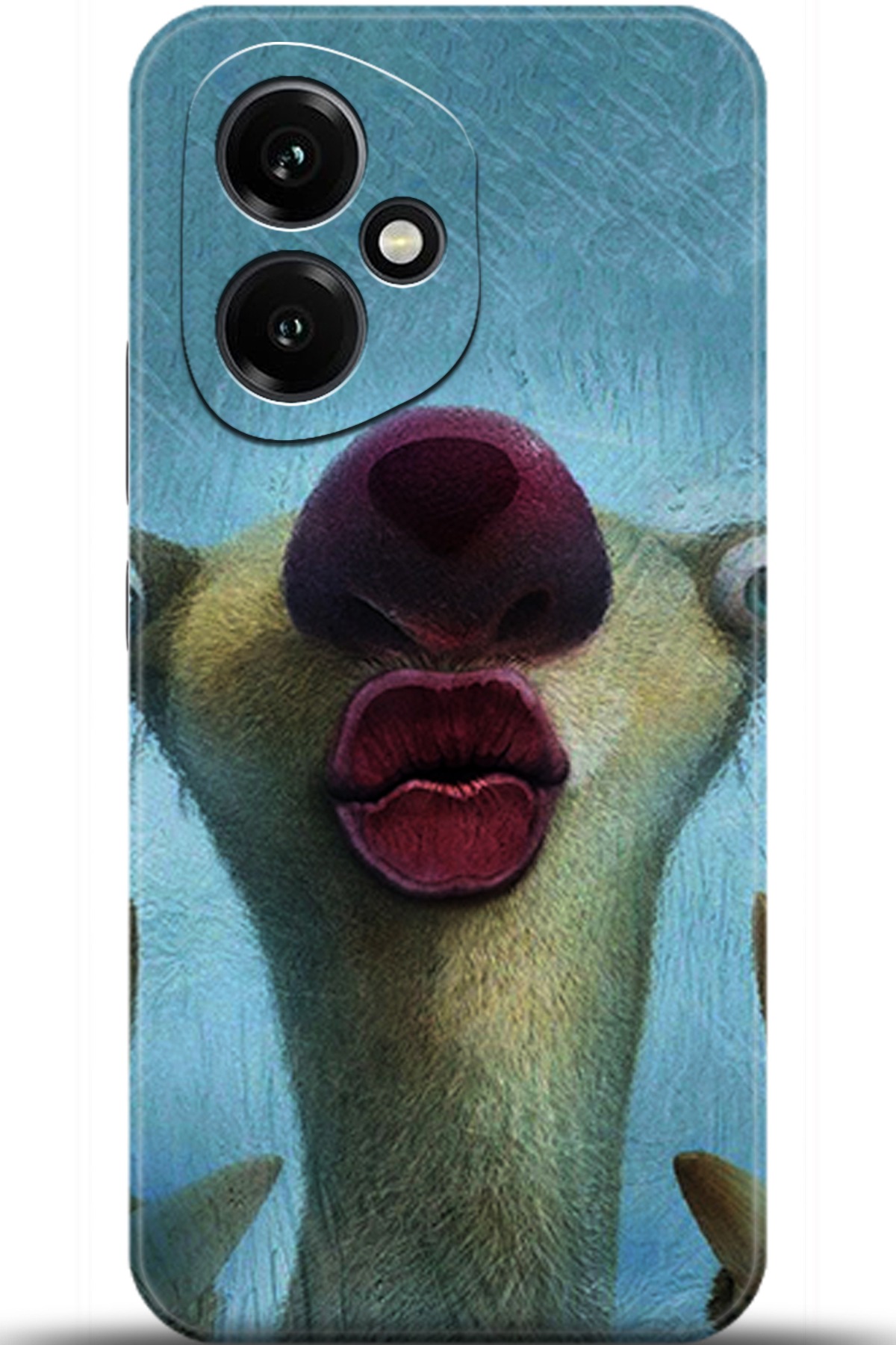 Honor 400 Uyumlu Kılıf HD Baskılı Kılıf - Followed Institution 5372