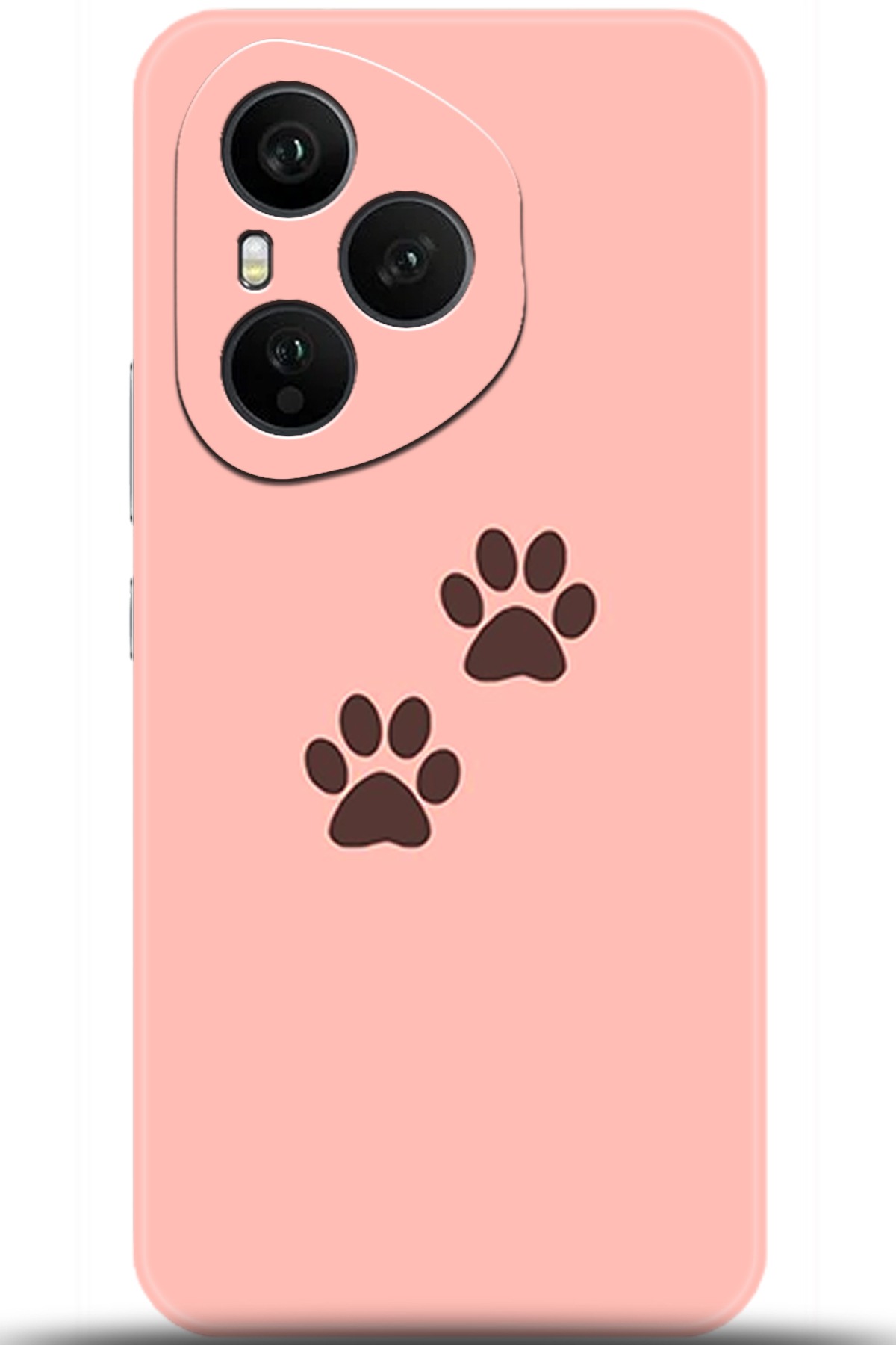 Honor 400 Pro Uyumlu Kılıf HD Baskılı Kılıf - Followed Institution 5615