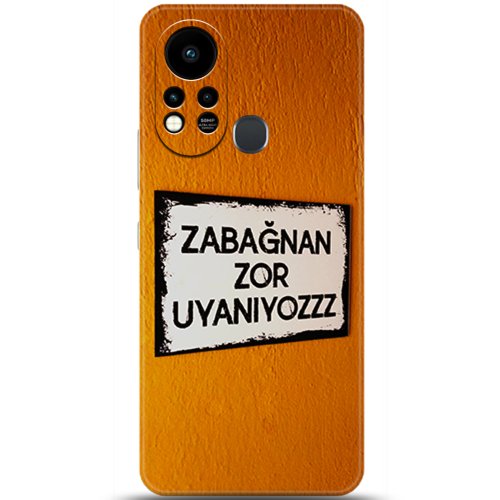 Uyumlu Kılıf HD Baskılı Kılıf - Followed Institution 5590