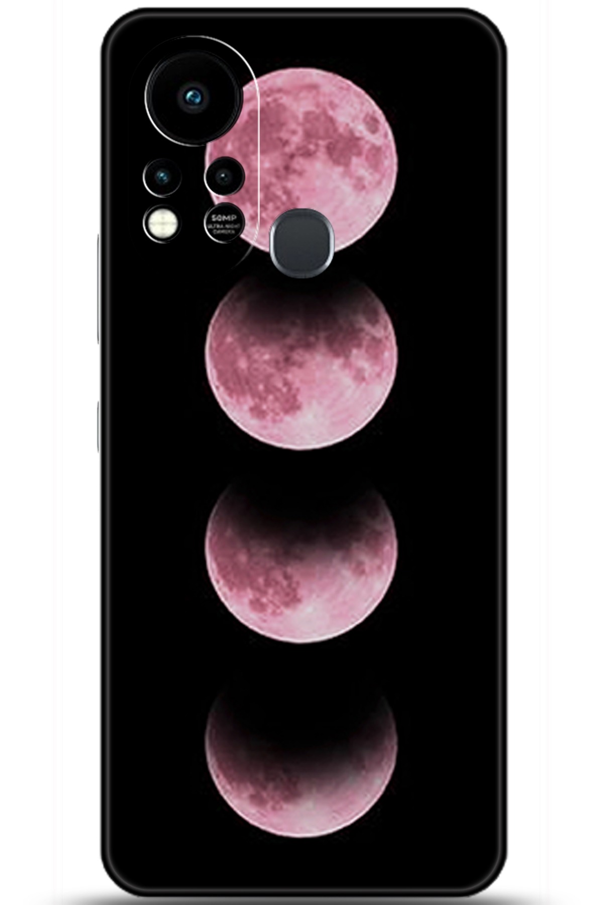 iNfinix Hot 11s Uyumlu Kılıf HD Baskılı Kılıf - Followed Institution 5915