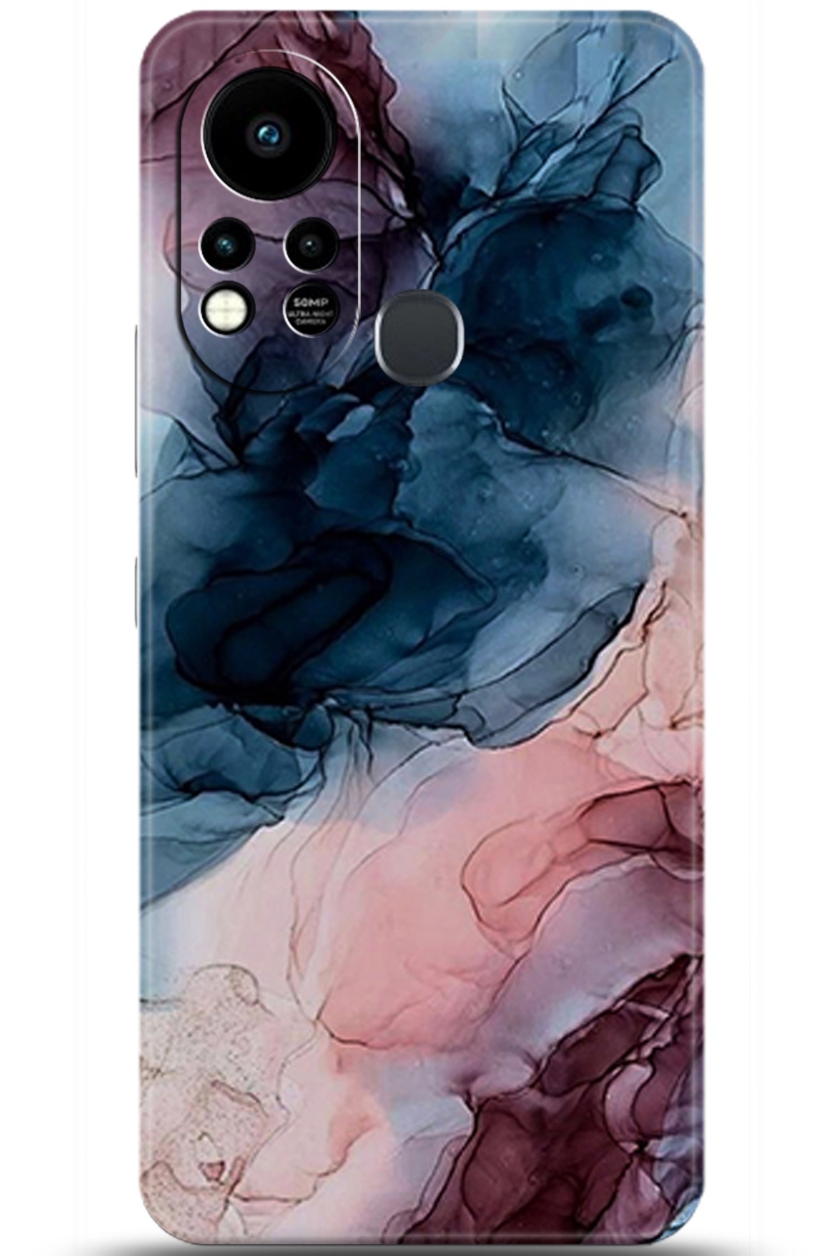 iNfinix Hot 11s Uyumlu Kılıf HD Baskılı Kılıf - Followed Institution 5985