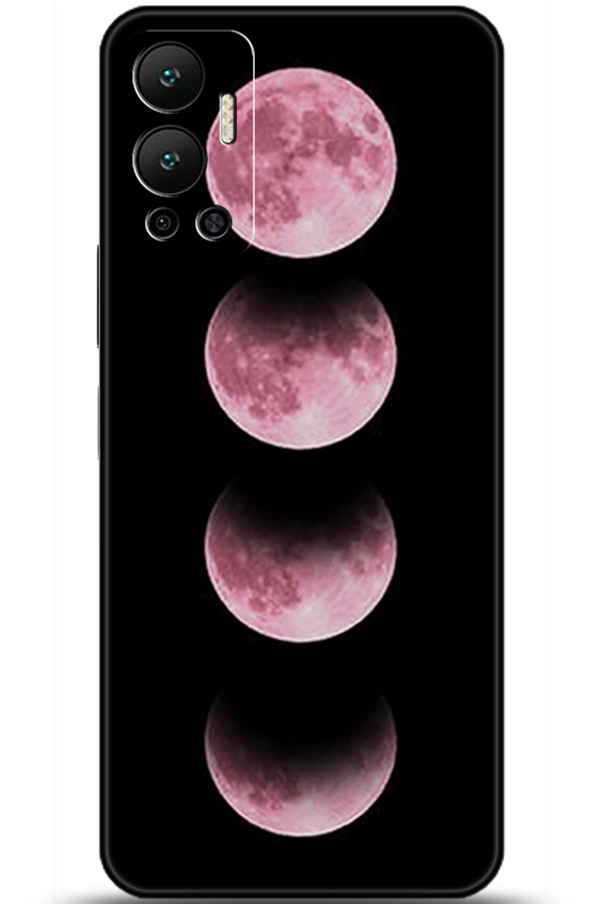 iNfinix Hot 12 Uyumlu Kılıf HD Baskılı Kılıf - Followed Institution 5915