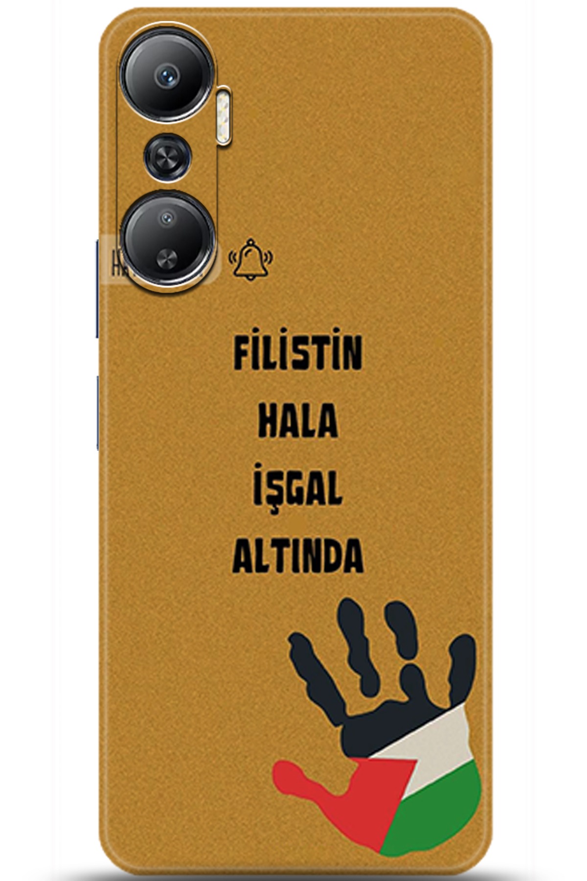 iNfinix Hot 20 Uyumlu Kılıf HD Baskılı Kılıf - Followed Institution 5740