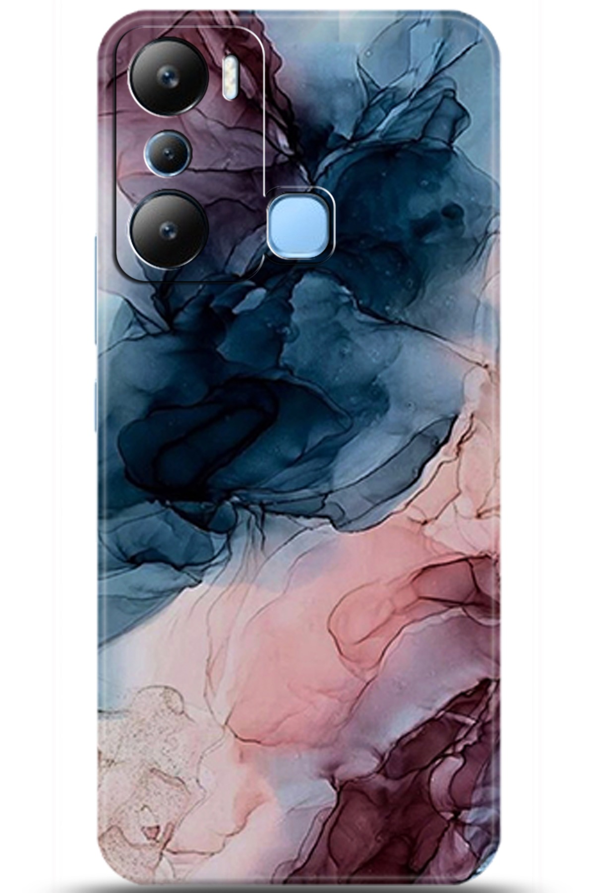 iNfinix Hot 20i Uyumlu Kılıf HD Baskılı Kılıf - Followed Institution 5985