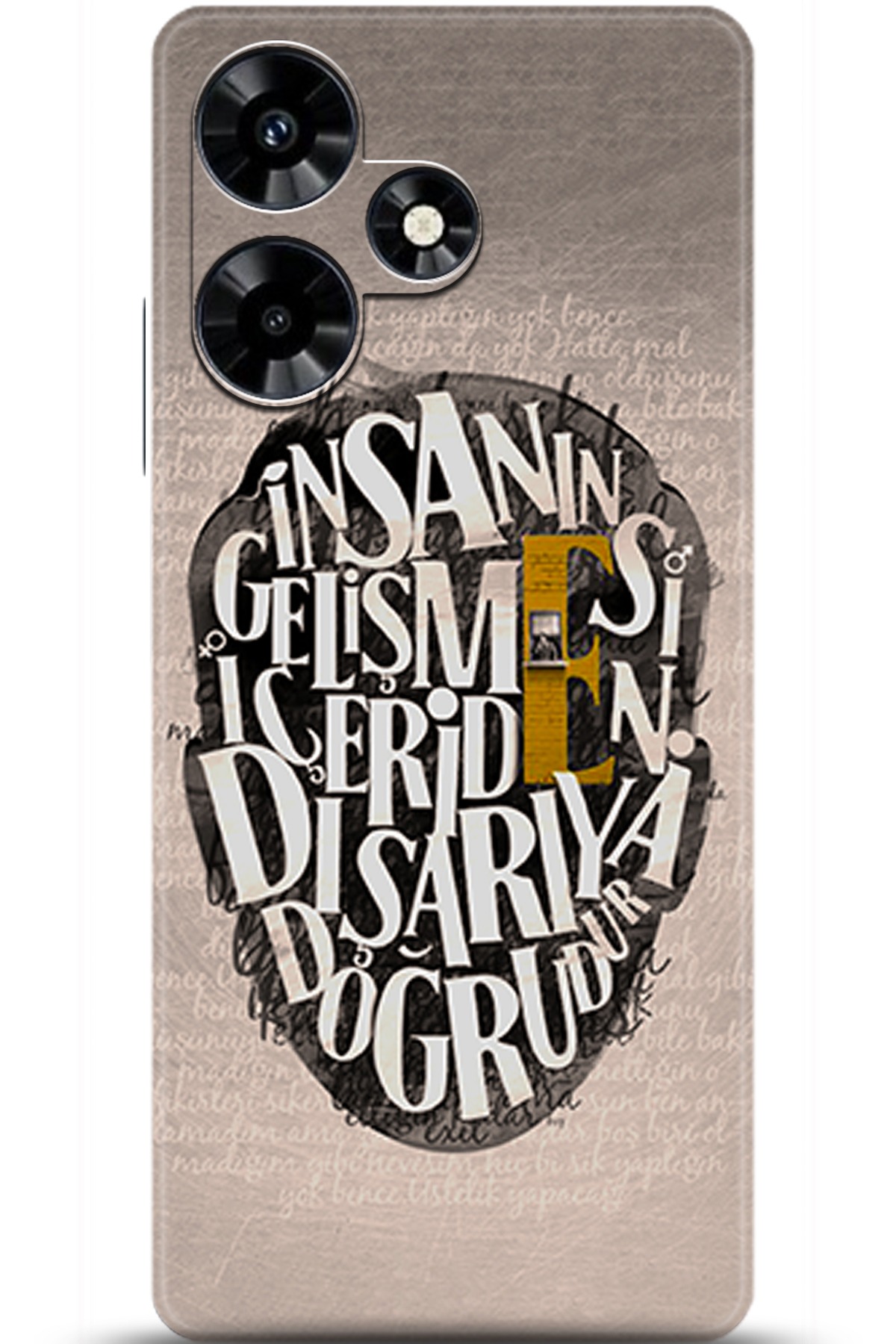 iNfinix Hot 30 Uyumlu Kılıf HD Baskılı Kılıf - Followed Institution 5587