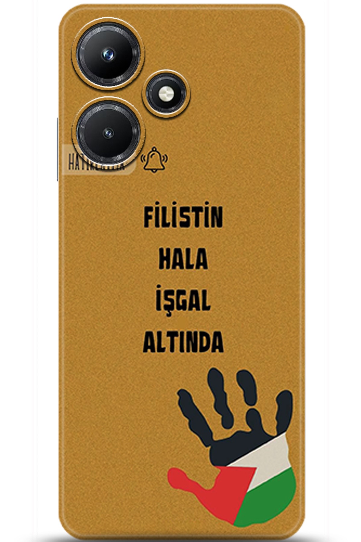 iNfinix Hot 30i Uyumlu Kılıf HD Baskılı Kılıf - Followed Institution 5740