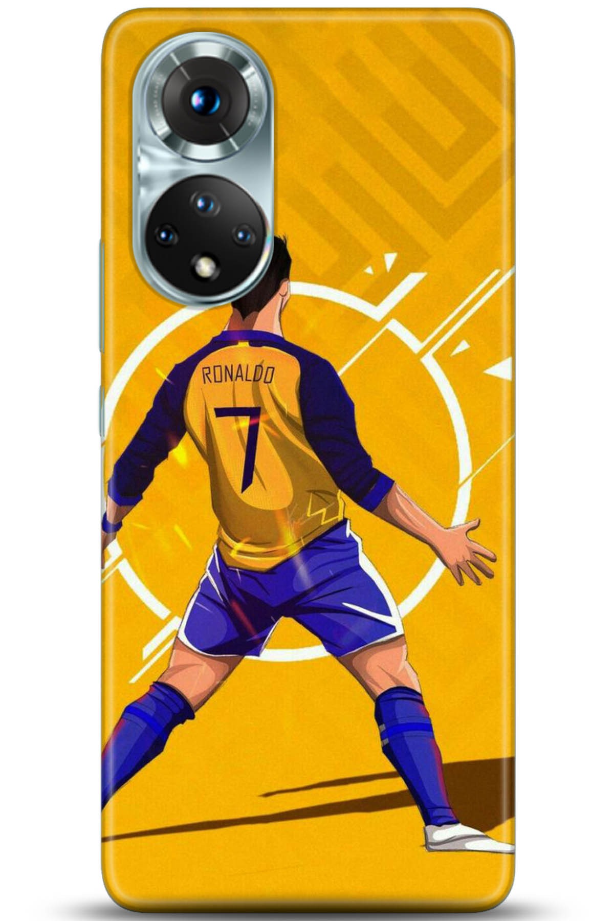 Honor 50 Kılıf HD Baskılı Kılıf - Followed Institution 5093