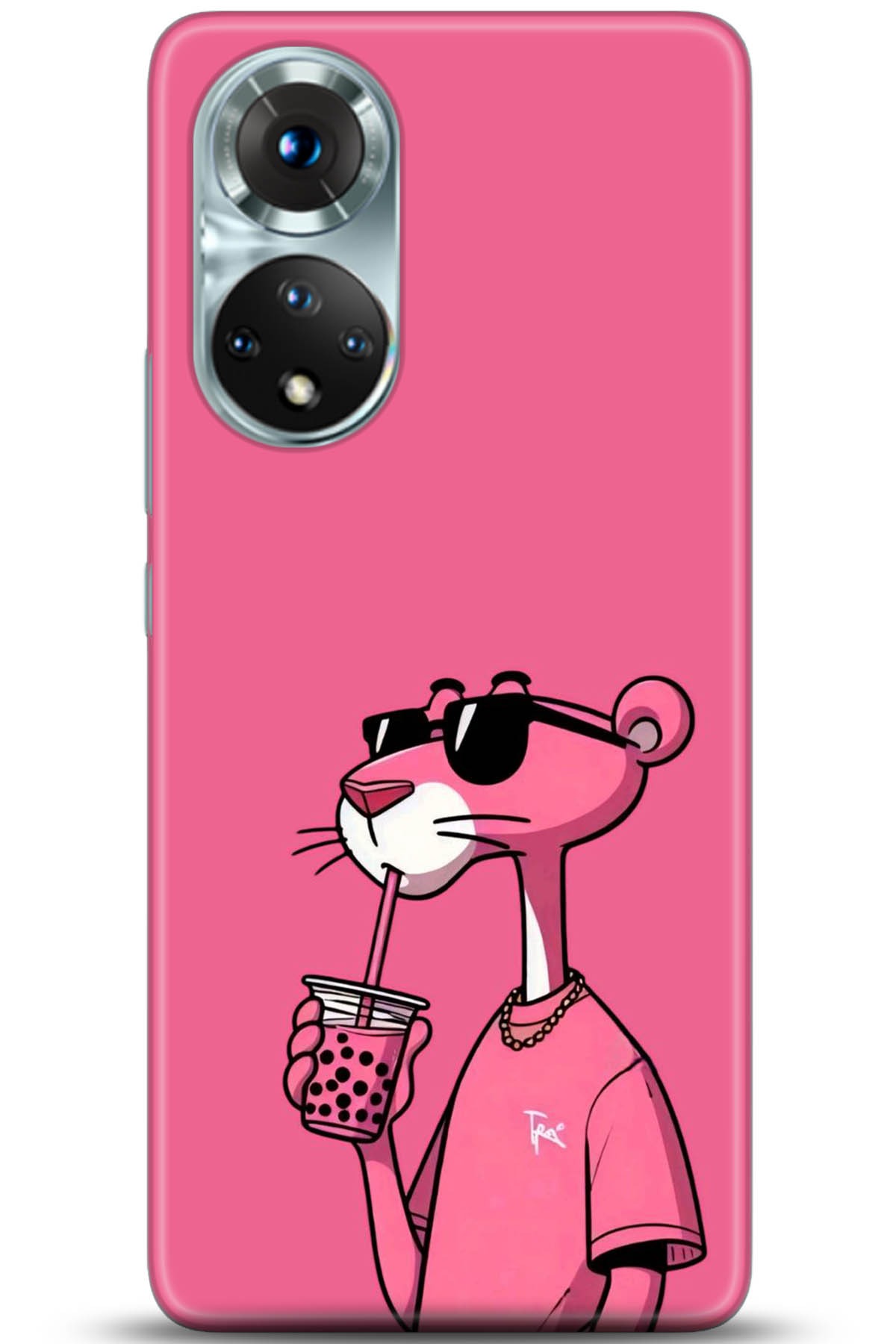 Honor 50 Kılıf HD Baskılı Kılıf - Followed Institution 5197