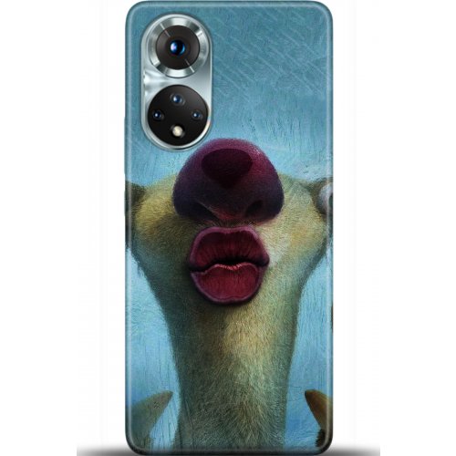 Kılıf HD Baskılı Kılıf - Followed Institution 5372