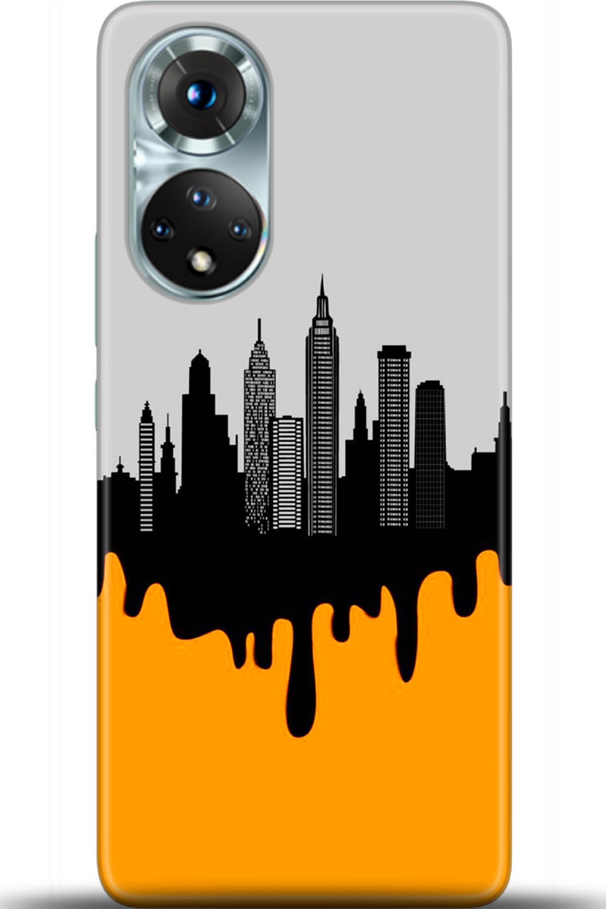 Honor 50 Kılıf HD Baskılı Kılıf - Followed Institution 5394