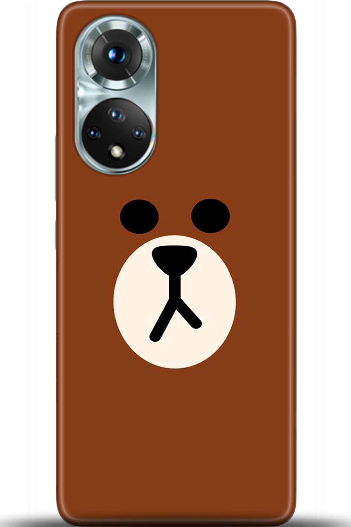 Honor 50 Kılıf HD Baskılı Kılıf - Followed Institution 5430