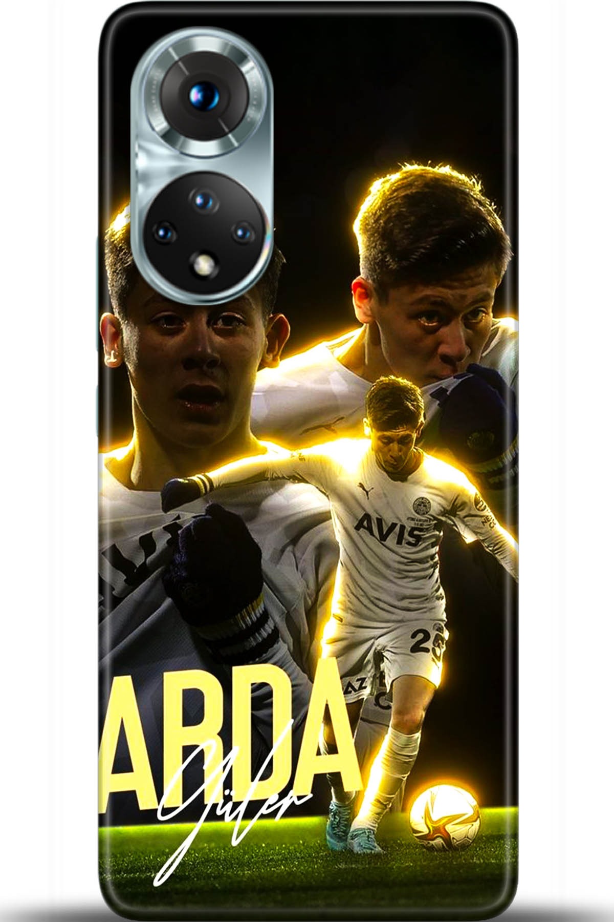 Honor 50 Kılıf HD Baskılı Kılıf - Followed Institution 5442