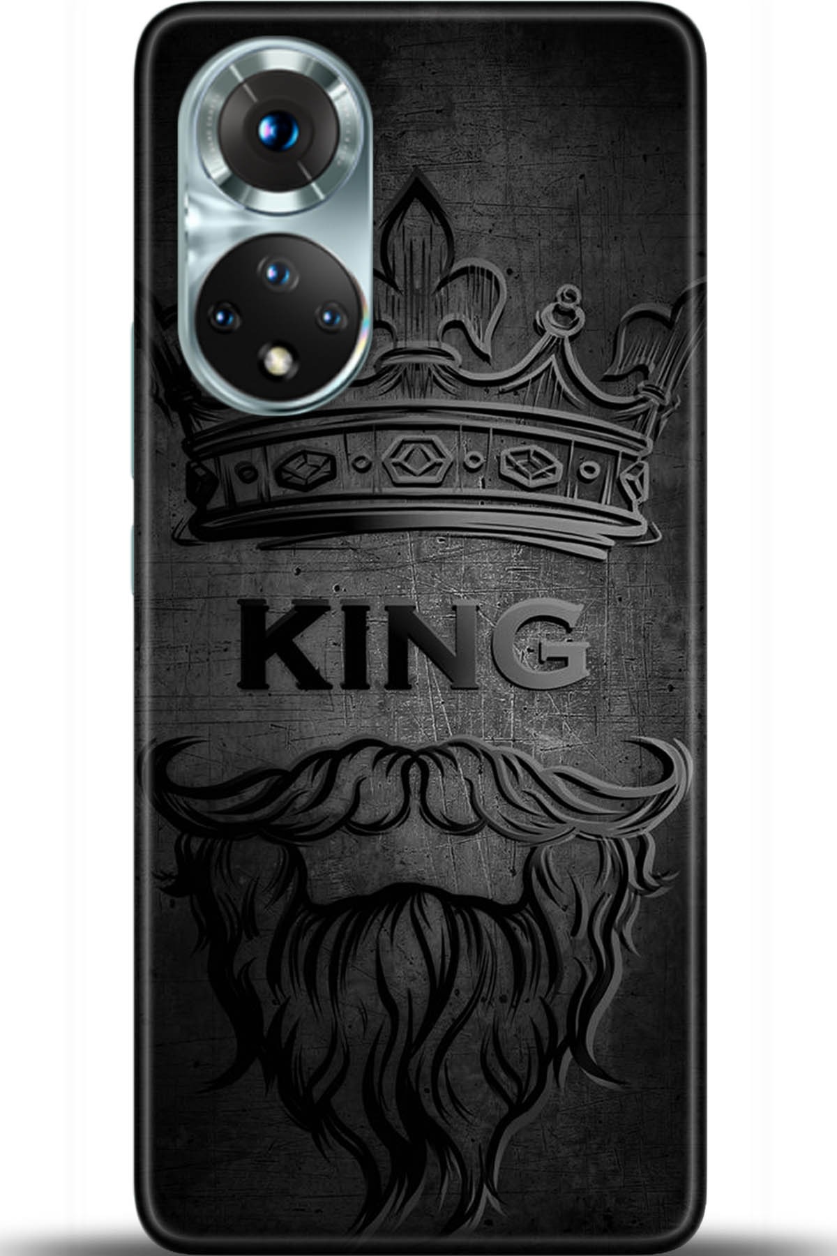 Honor 50 Kılıf HD Baskılı Kılıf - Followed Institution 5456