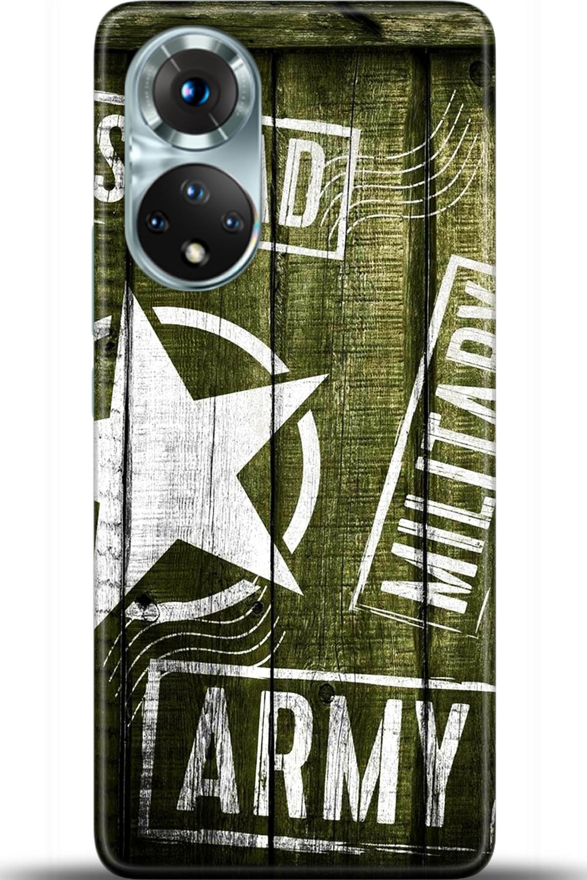 Honor 50 Kılıf HD Baskılı Kılıf - Followed Institution 5476