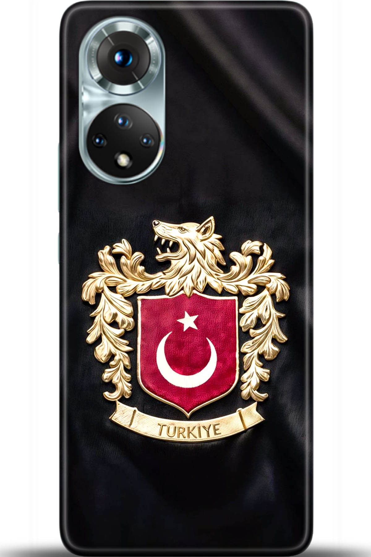 Honor 50 Kılıf HD Baskılı Kılıf - Followed Institution 5532