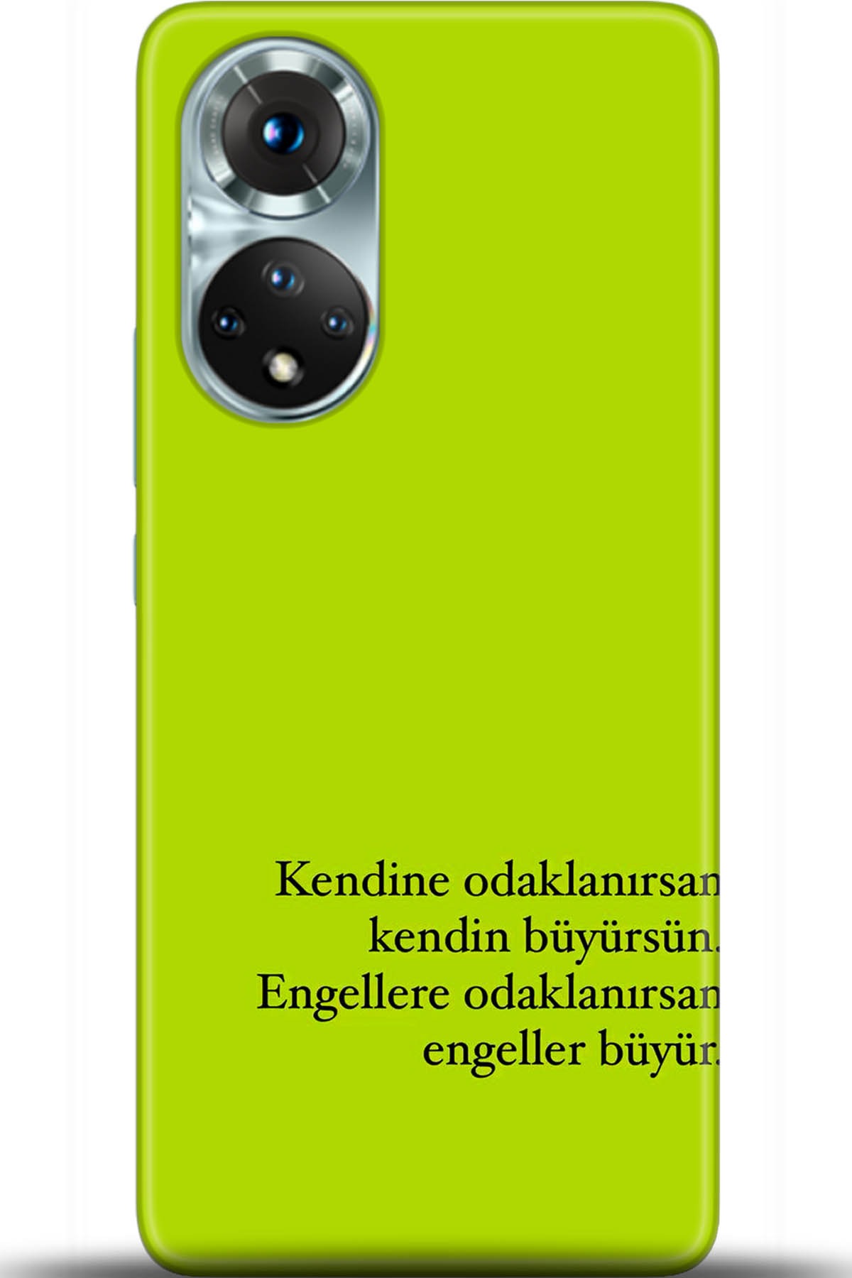 Honor 50 Kılıf HD Baskılı Kılıf - Followed Institution 5593