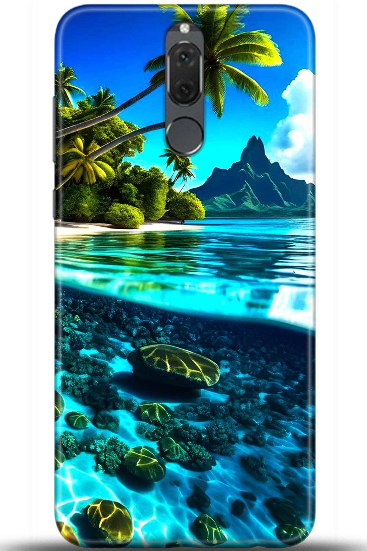 Huawei Mate 10 Lite Uyumlu Kılıf HD Baskılı Kılıf - Followed Institution 5491