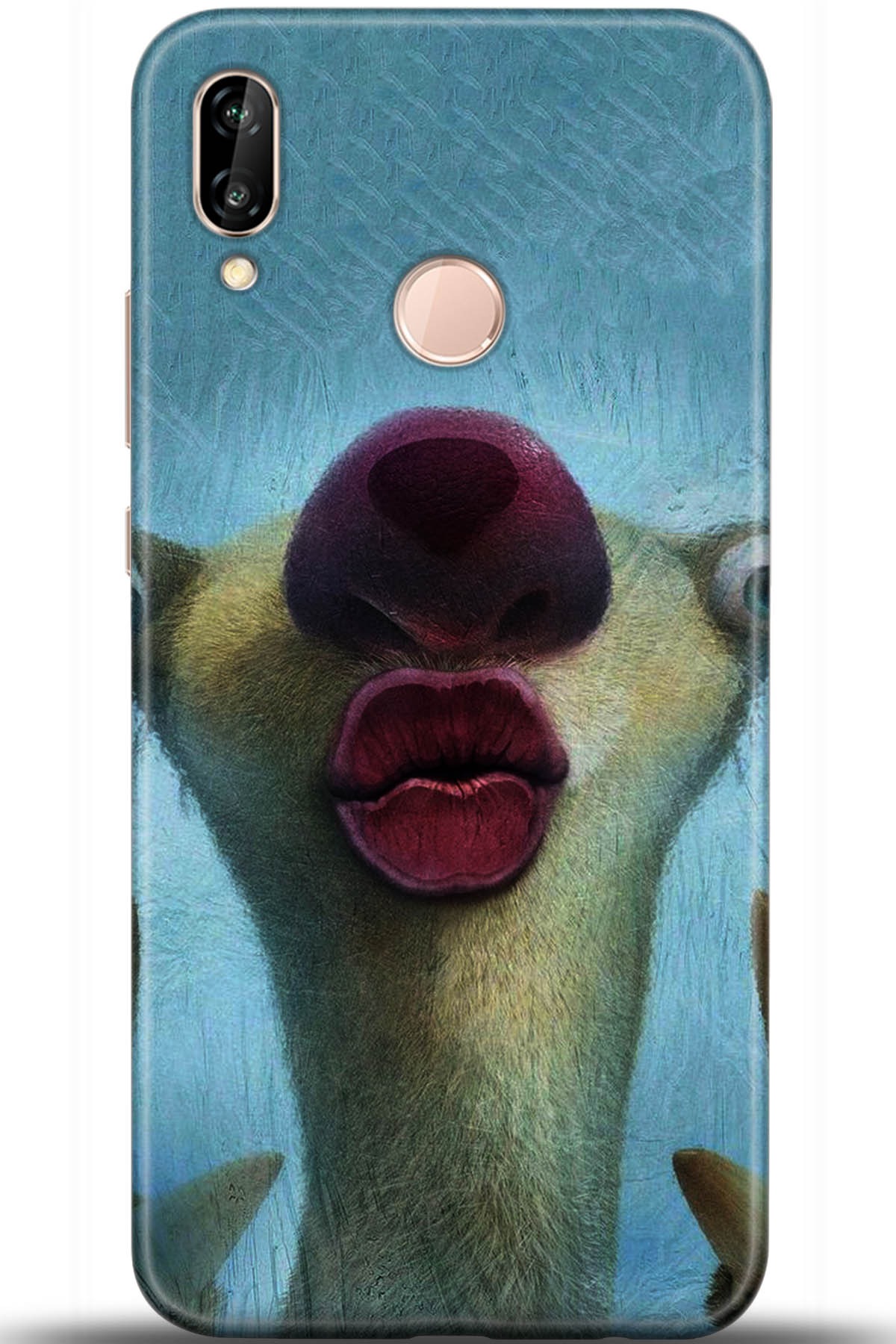 Huawei P20 Lite Uyumlu Kılıf HD Baskılı Kılıf - Followed Institution 5372