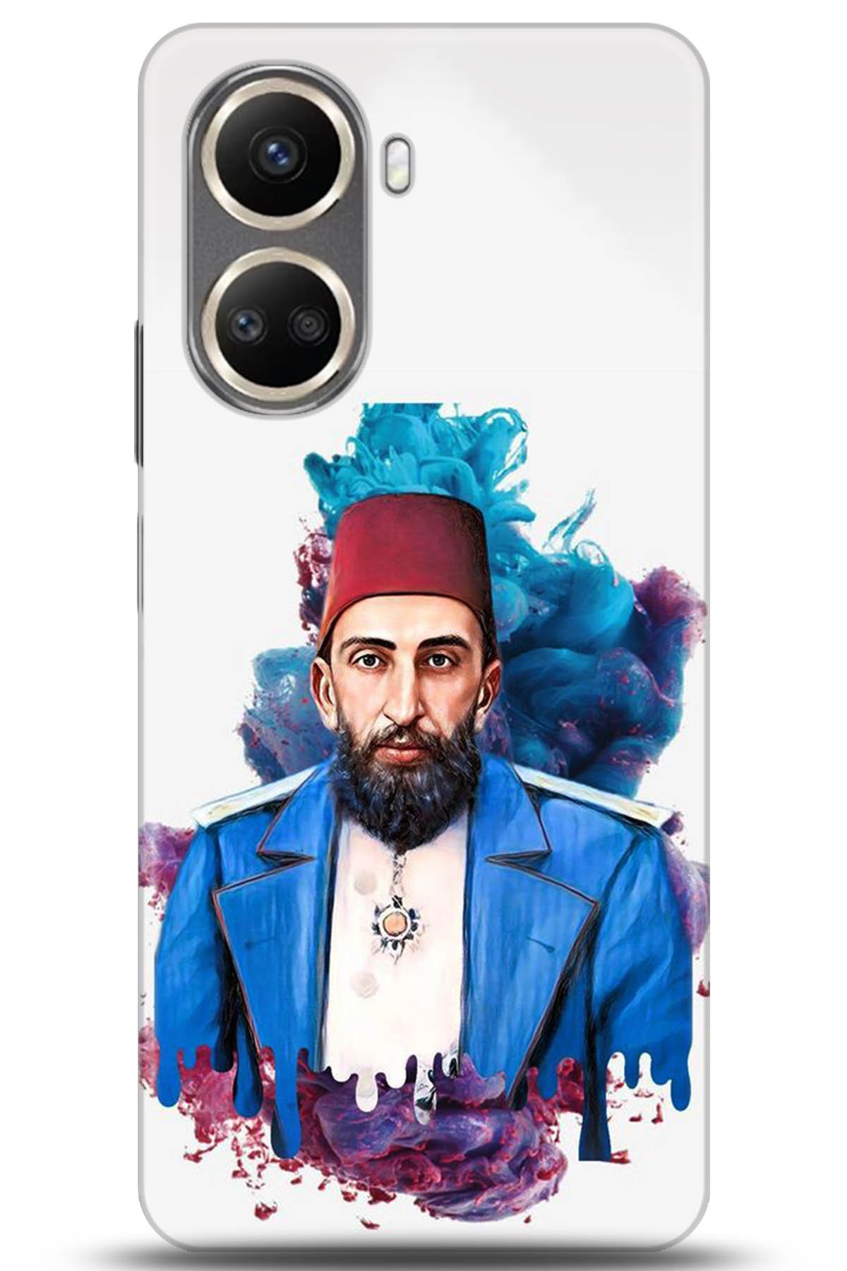Huawei Nova 10 Uyumlu Kılıf HD Baskılı Kılıf - Followed Institution 5201