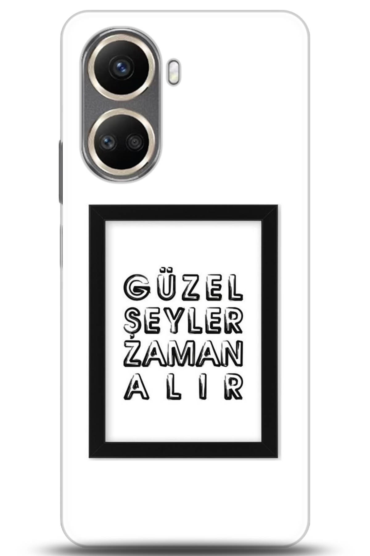 Huawei Nova 10 Uyumlu Kılıf HD Baskılı Kılıf - Followed Institution 5307